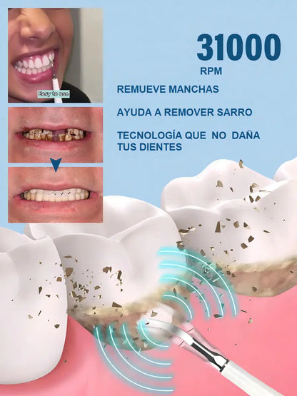 Cepillo Dental Eléctrico Kit Limpiador De Dientes Ultrasónico Removedor De Sarro Portátil Usb Blanco